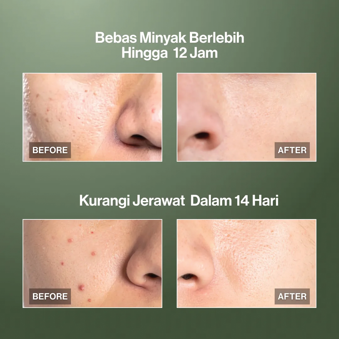 Kahf Oil and Acne Care Face Wash 100 ml