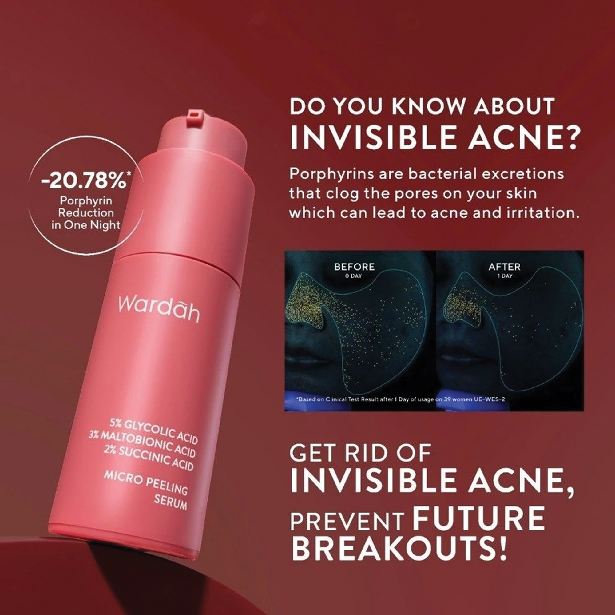 Wardah 5% Glycolic Acid 3% Maltobionic Acid 2% Succinic Acid Micro Peeling Serum