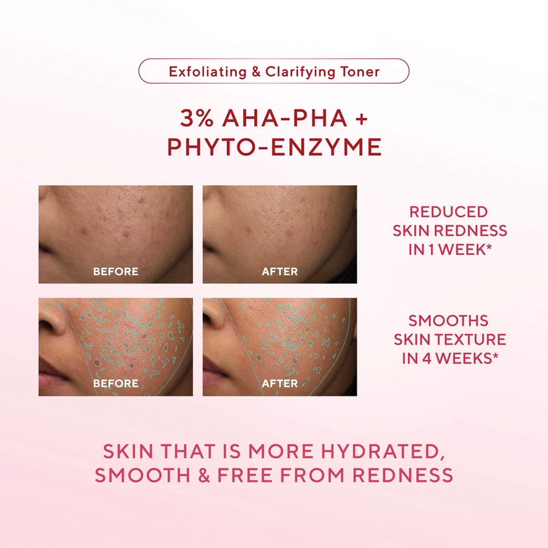 Wardah 3% AHA-PHA Phyto-Enzyme Exfoliating & Clarifying Toner 100 ml