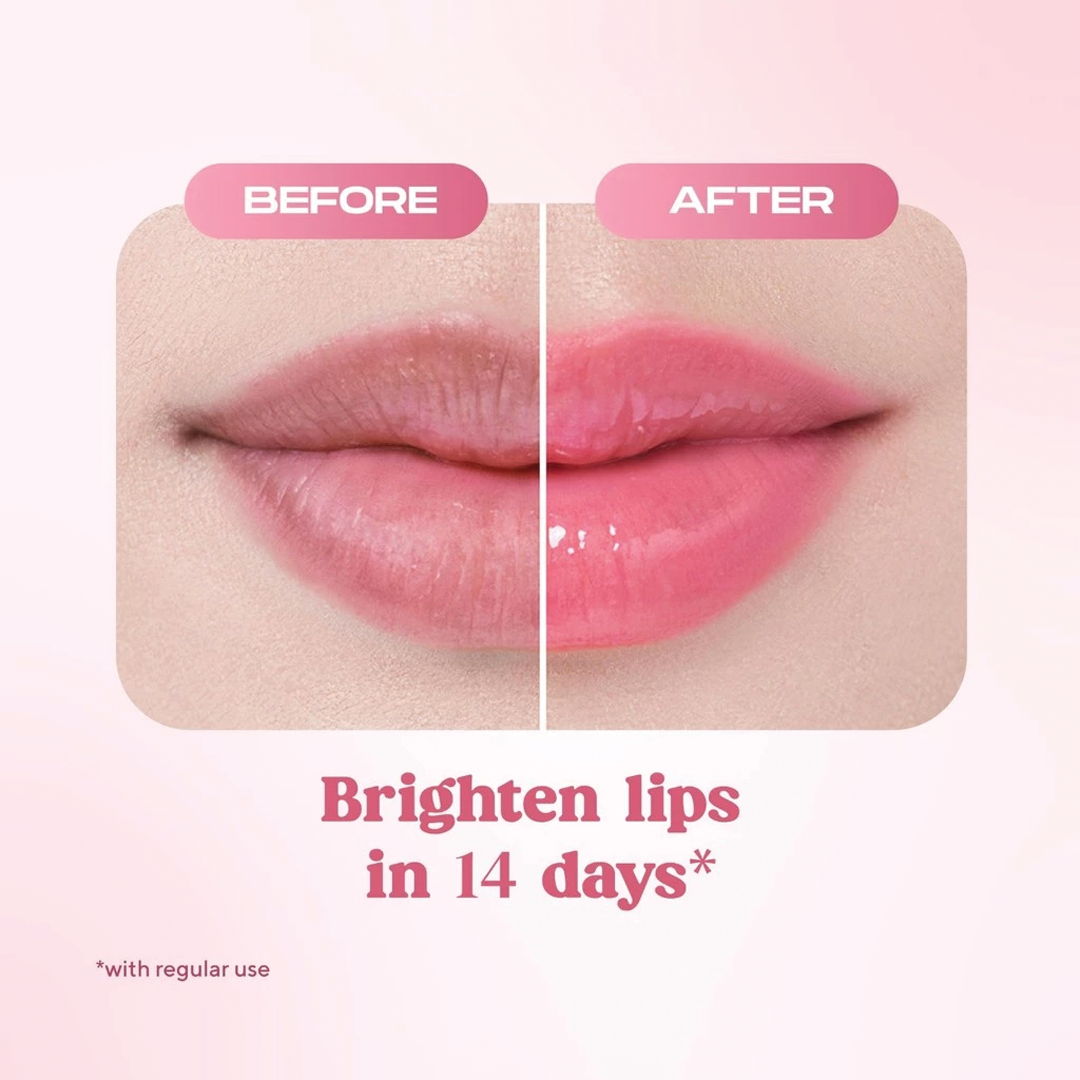 Wardah Lip Rescue Jelly Balm Dusty Rose - Brighten Dark Lips, Plump-pillow like,Hydrates, Smoothen Lips,Vitamin C