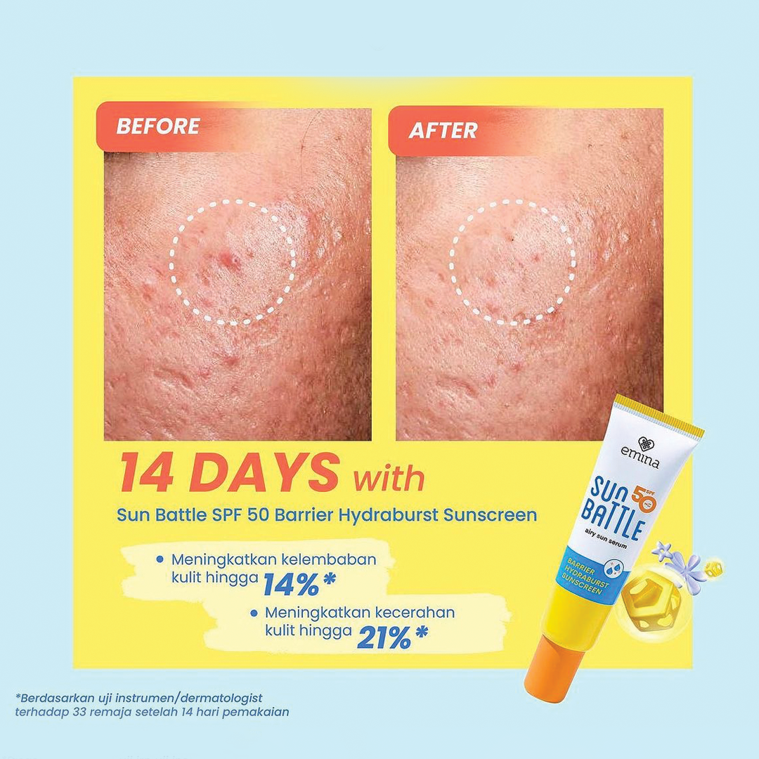 Emina Sun Battle SPF 50 PA++++ Barrier Hydraburst Sunscreen 30 ml