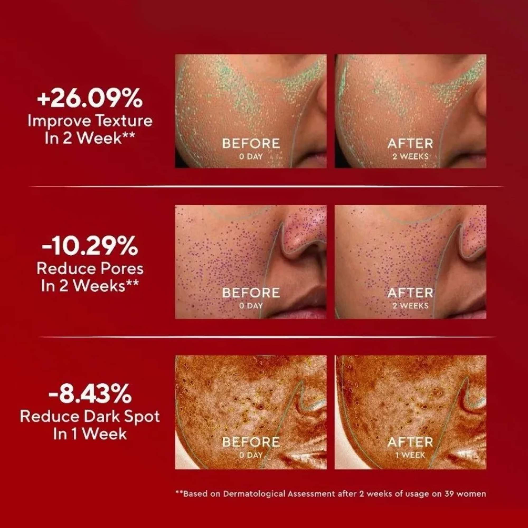 Wardah 5% Glycolic Acid 3% Maltobionic Acid 2% Succinic Acid Micro Peeling Serum