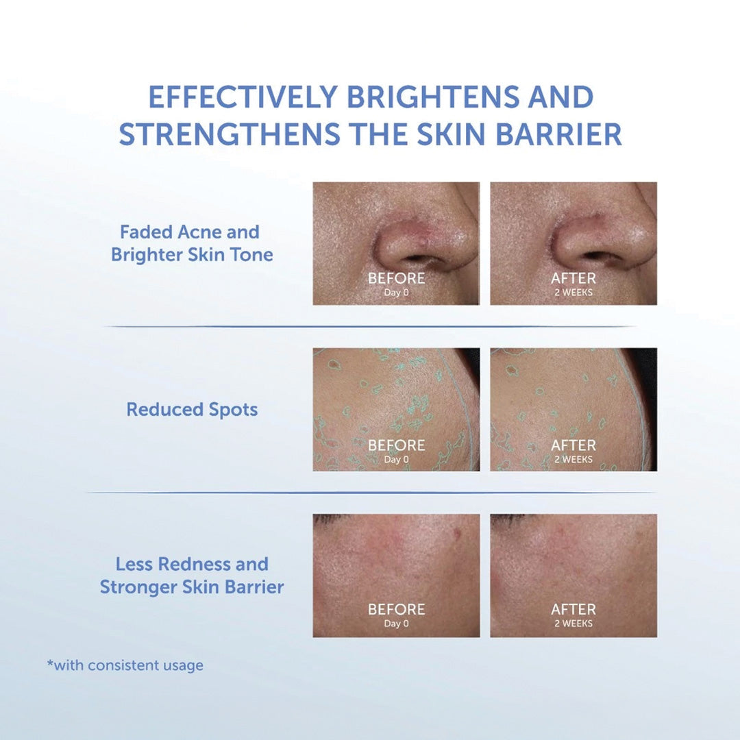 Light+ by Wardah Hydrashot Intensive Moisturizer 30 g
