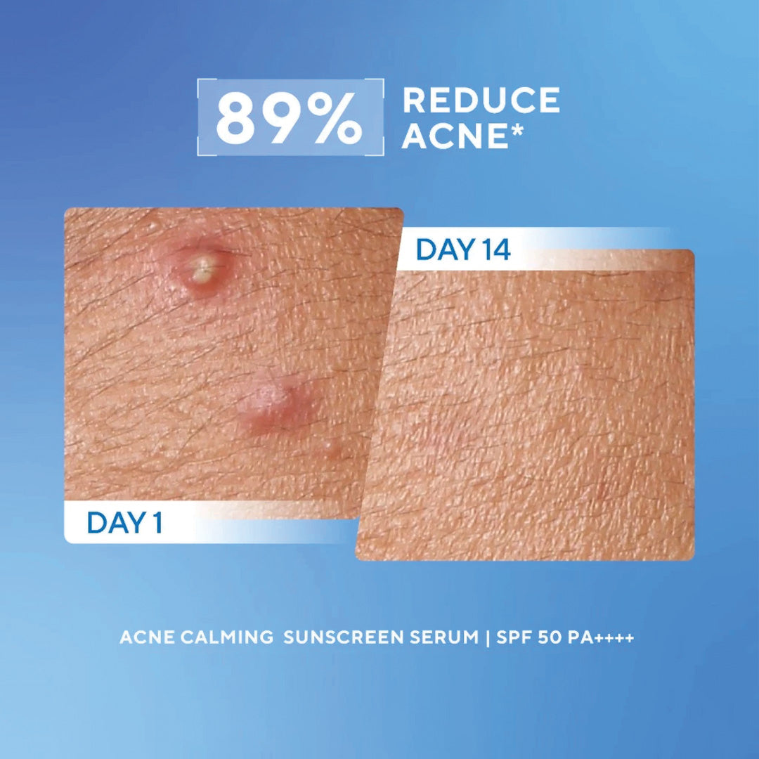 Wardah UV Shield Acne Calming Sunscreen Serum SPF 50 PA++++ 40 ml